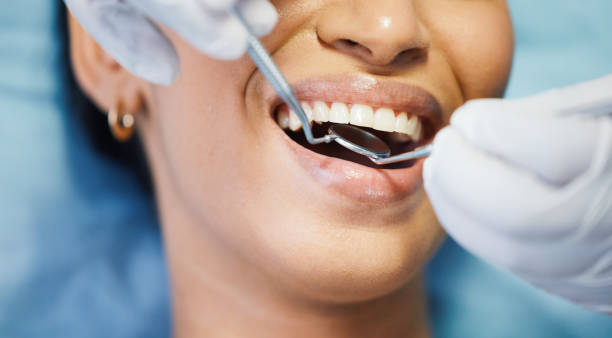 Best After-Hours Dental Trauma Care in Saratoga, WY