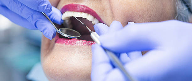 Best Emergency Treatment for Dental Infections or Abscesses in Saratoga, WY
